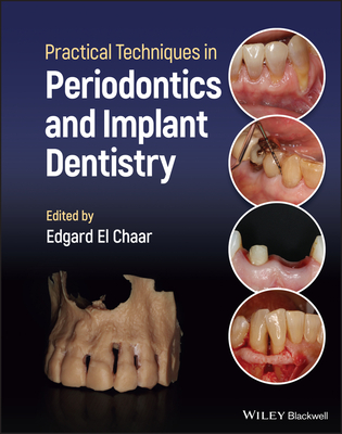 Practical Techniques in Periodontics and Implant Dentistry - El Chaar, Edgard (Editor)