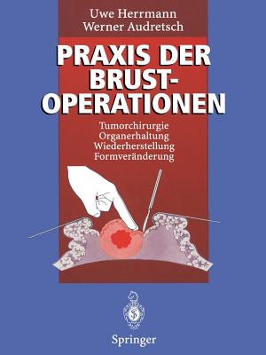 Praxis Der Brustoperationen: Tumorchirurgie -- Organerhaltung -- Wiederherstellung -- Formveranderung - Herrmann, Uwe, and Audretsch, Werner