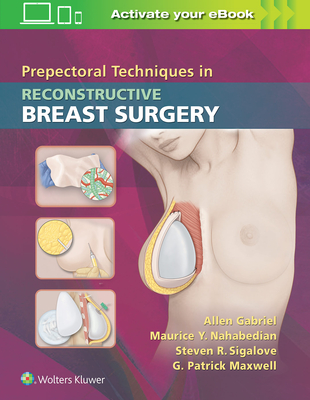 Prepectoral Techniques in Reconstructive Breast Surgery - Gabriel, Allen, MD, FACS (Editor), and Nahabedian, Maurice Y., MD, FACS (Editor), and Sigalove, Steven R, MD, FACS (Editor)