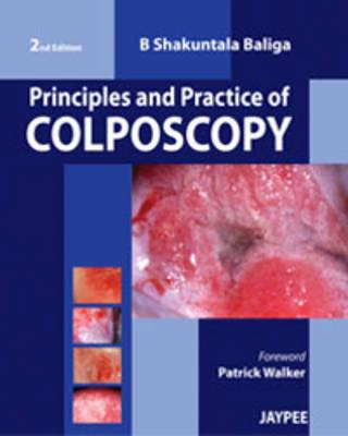 Principles and Practice of Colposcopy - Baliga, B Shakuntala