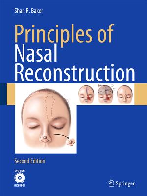 Principles of Nasal Reconstruction - Baker, Shan R.