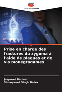 Prise en charge des fractures du zygoma ? l'aide de plaques et de vis biod?gradables