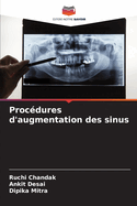 Procdures d'augmentation des sinus