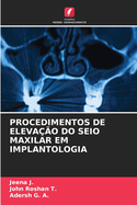 Procedimentos de Eleva??o Do Seio Maxilar Em Implantologia