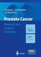 Prostate Cancer: Diagnosis and Surgical Treatment