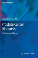 Prostate Cancer Diagnosis: Psa, Biopsy and Beyond