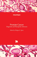 Prostate Cancer: Diagnostic and Therapeutic Advances