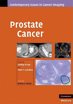 Prostate Cancer - Hricak, Hedvig (Editor), and Scardino, Peter (Editor)