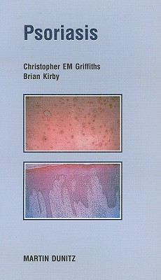 Psoriasis: Pocketbook - Griffiths, Christopher Em, and Kirby, Brian