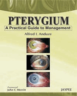 Pterygium - A Practical Guide to Management