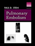 Pulmonary Embolism - Stein, Paul D