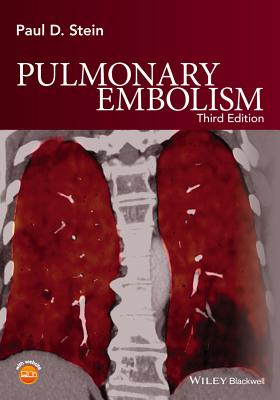 Pulmonary Embolism - Stein, Paul D.