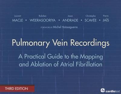 Pulmonary Vein Recordings: A Practical Guide to the Mapping and Ablation of Atrial Fibrillation - Macle, Laurent, and Weerasooriya, Rukshen, and Andrade, Jason