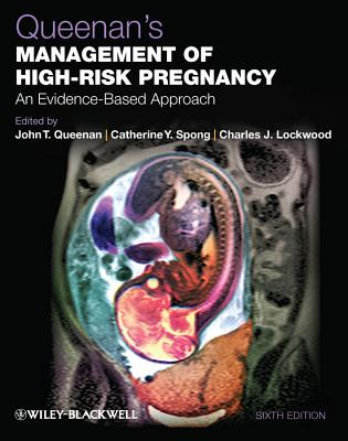 Queenan's Management of High-Risk Pregnancy: An Evidence-Based Approach - Queenan, John T. (Editor), and Spong, Catherine Y. (Editor), and Lockwood, Charles J. (Editor)