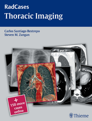 Radcases Thoracic Imaging - Restrepo, Carlos S (Editor), and Zangan, Steven M (Editor)