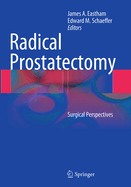 Radical Prostatectomy: Surgical Perspectives