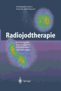 Radiojodtherapie: Bei Benignen Und Malignen Schilddrusenerkrankungen