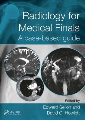 Radiology for Medical Finals: A case-based guide - Sellon, Edward (Editor), and Howlett, David (Editor)