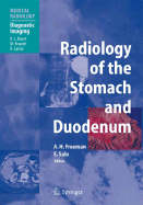 Radiology of the Stomach and Duodenum