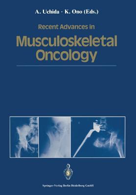 Recent Advances in Musculoskeletal Oncology - Uchida, Atsumasa (Editor), and Ono, Keiro (Editor)