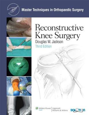 Reconstructive Knee Surgery - Jackson, Douglas W. (Editor)