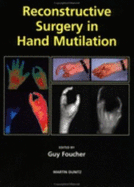 Reconstructive Surgery in Hand Mutilation - Foucher, Guy