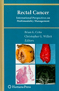 Rectal Cancer: International Perspectives on Multimodality Management