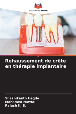 Rehaussement de crte en thrapie implantaire - Hegde, Shashikanth, and Nawfal, Mohamed, and K S, Rajesh