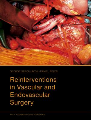 Reinterventions in Vascular and Endovascular Surgery - Geroulakos, George (Editor), and Reddy, Daniel (Editor)