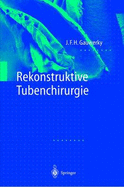 Rekonstruktive Tubenchirurgie