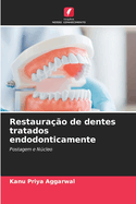 Restaura??o de dentes tratados endodonticamente