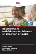 Restaurations esth?tiques ant?rieures en dentition primaire