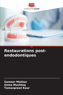 Restaurations post-endodontiques