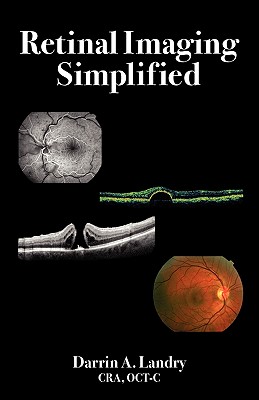 Retinal Imaging Simplified - Landry, Darrin A, and Rogers, Adam H, MD (Foreword by), and Evans, Patricia (Editor)