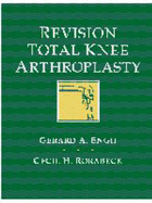 Revision Total Knee Arthroplasty