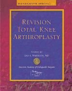 Revision Total Knee Arthroplasty - Whiteside, Leo A