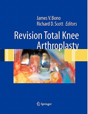 Revision Total Knee Arthroplasty - Bono, James V. (Editor), and Ranawat, C.S. (Foreword by), and Scott, Richard D. (Editor)