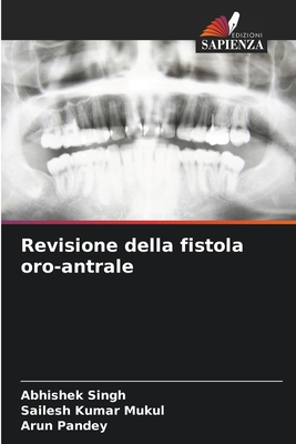 Revisione della fistola oro-antrale - Singh, Abhishek, and Mukul, Sailesh Kumar, and Pandey, Arun