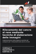 Rilevamento del cancro al rene mediante tecniche di elaborazione delle immagini