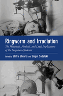 Ringworm and Irradiation: The Historical, Medical, and Legal Implications of the Forgotten Epidemic