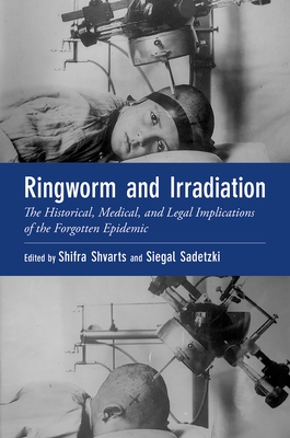 Ringworm and Irradiation: The Historical, Medical, and Legal Implications of the Forgotten Epidemic - Shvarts, Shifra, and Sadetzki, Siegal