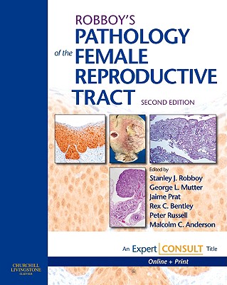Robboy's Pathology of the Female Reproductive Tract: Expert Consult: Online and Print - Mutter, George L, MD, and Robboy, Stanley J, MD, and Prat, Jaime, MD, PhD