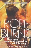 Rope burns