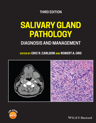 Salivary Gland Pathology: Diagnosis and Management - Carlson, Eric R. (Editor), and Ord, Robert A. (Editor)