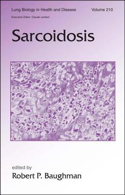 Sarcoidosis - Baughman, Robert (Editor)