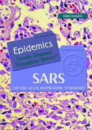 Sars (Severe Acute Respiratory Syndrome)