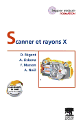 Scanner Et Rayons X