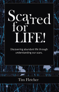 Scarred For Life!: Discovering Abundant Life Through Understanding Our Scars