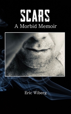 Scars: A Morbid Memoir - Wiberg, Eric