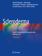 Scleroderma: From Pathogenesis to Comprehensive Management